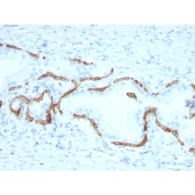 Immunohistochemistry - Anti-Cytokeratin 5 + 6 Antibody [KRT5.6/2438] - BSA and Azide free (A254143) - Antibodies.com