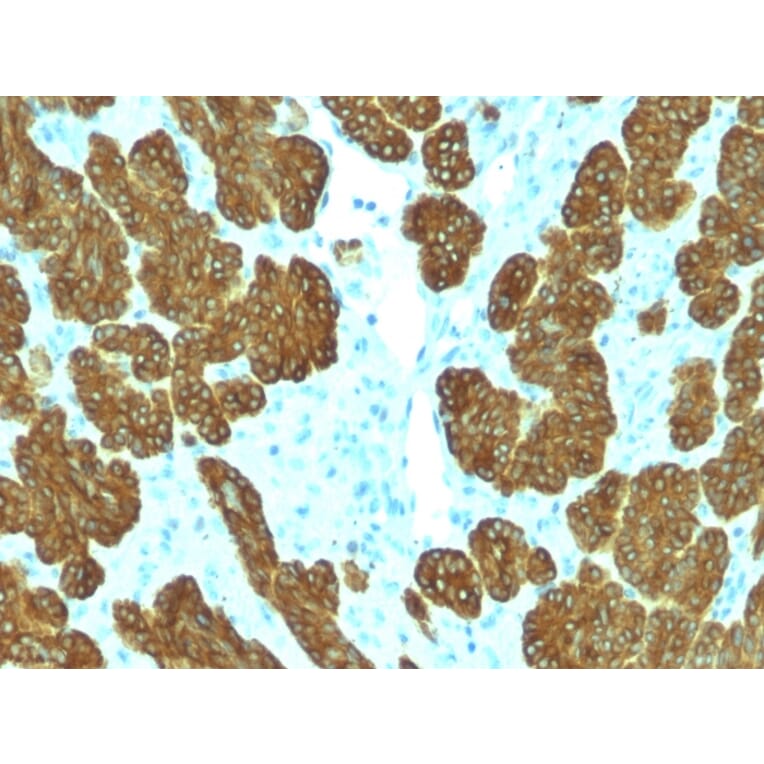Immunohistochemistry - Anti-Cytokeratin 5 + 6 Antibody [KRT5.6/2438] - BSA and Azide free (A254143) - Antibodies.com