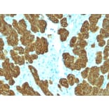Immunohistochemistry - Anti-Cytokeratin 5 + 6 Antibody [KRT5.6/2438] - BSA and Azide free (A254143) - Antibodies.com