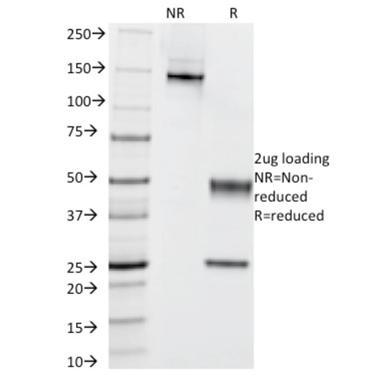 SDS-PAGE - Anti-Cytokeratin 5 + 6 Antibody [KRT5.6/2438] - BSA and Azide free (A254143) - Antibodies.com
