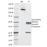 SDS-PAGE - Anti-Cytokeratin 5 + 6 Antibody [KRT5.6/2438] - BSA and Azide free (A254143) - Antibodies.com