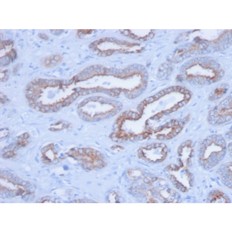 Immunohistochemistry - Anti-pan Cytokeratin Antibody [PCK/3150] - BSA and Azide free (A254144) - Antibodies.com