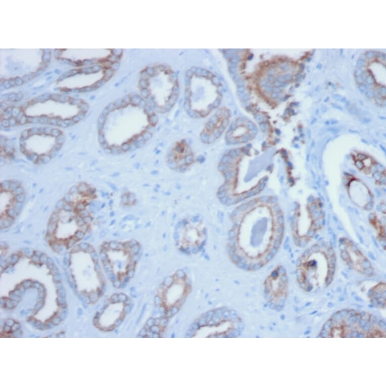 Immunohistochemistry - Anti-pan Cytokeratin Antibody [PCK/3150] - BSA and Azide free (A254144) - Antibodies.com