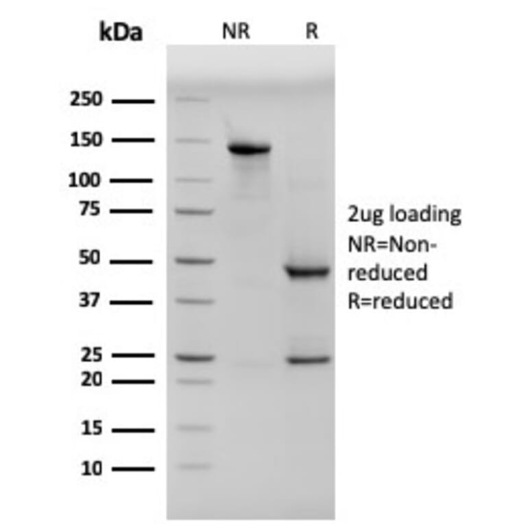 SDS-PAGE - Anti-pan Cytokeratin Antibody [PCK/3150] - BSA and Azide free (A254144) - Antibodies.com
