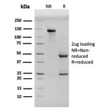 SDS-PAGE - Anti-pan Cytokeratin Antibody [PCK/3150] - BSA and Azide free (A254144) - Antibodies.com