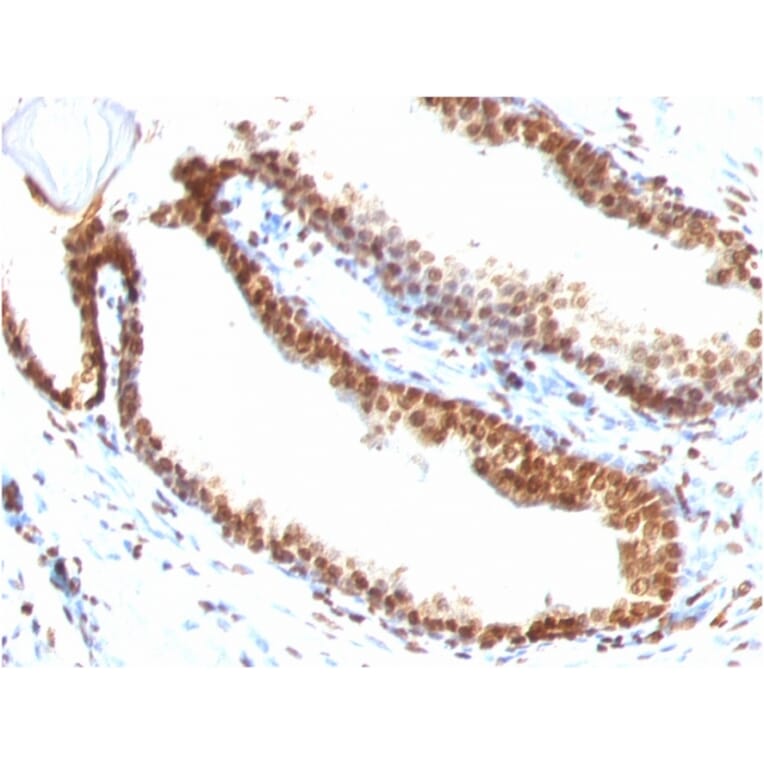 Immunohistochemistry - Anti-ds DNA Antibody [DSD/958] - BSA and Azide free (A254144) - Antibodies.com