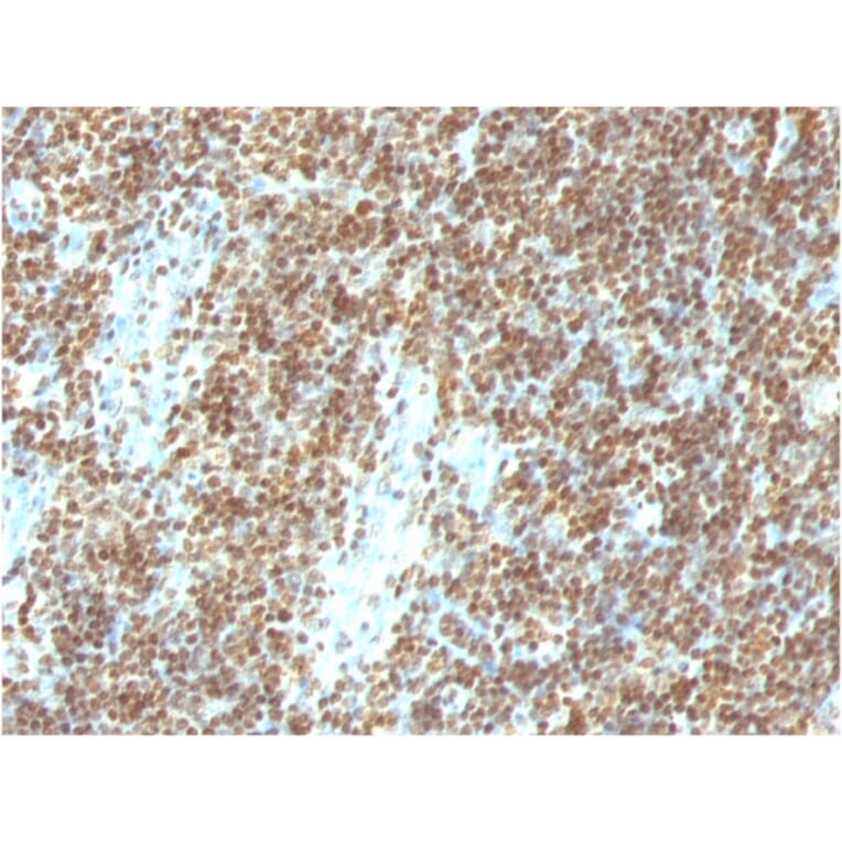 Immunohistochemistry - Anti-ds DNA Antibody [DSD/958] - BSA and Azide free (A254145) - Antibodies.com