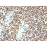 Immunohistochemistry - Anti-ds DNA Antibody [DSD/958] - BSA and Azide free (A254145) - Antibodies.com