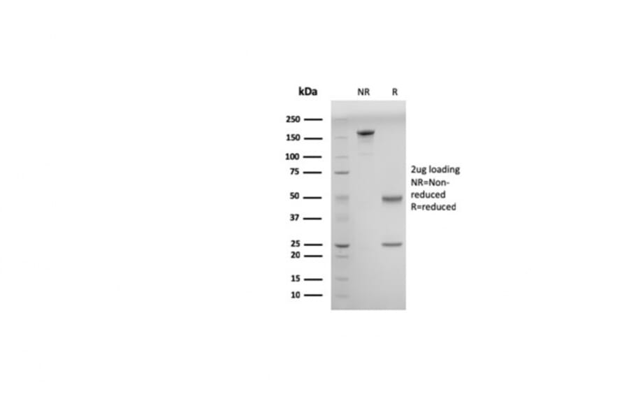 SDS-PAGE - Anti-ds DNA Antibody [DSD/958] - BSA and Azide free (A254145) - Antibodies.com
