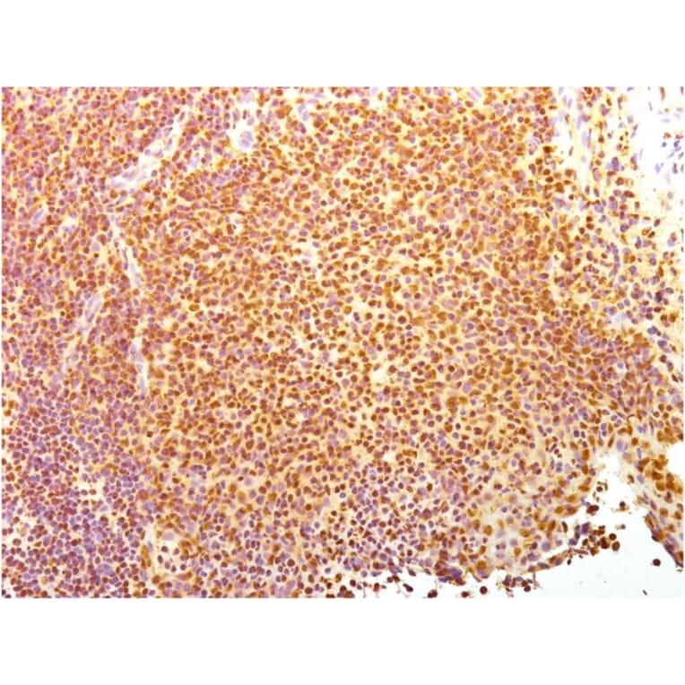 Immunohistochemistry - Anti-Human Nuclear Antigen Antibody [235-1] - BSA and Azide free (A254146) - Antibodies.com