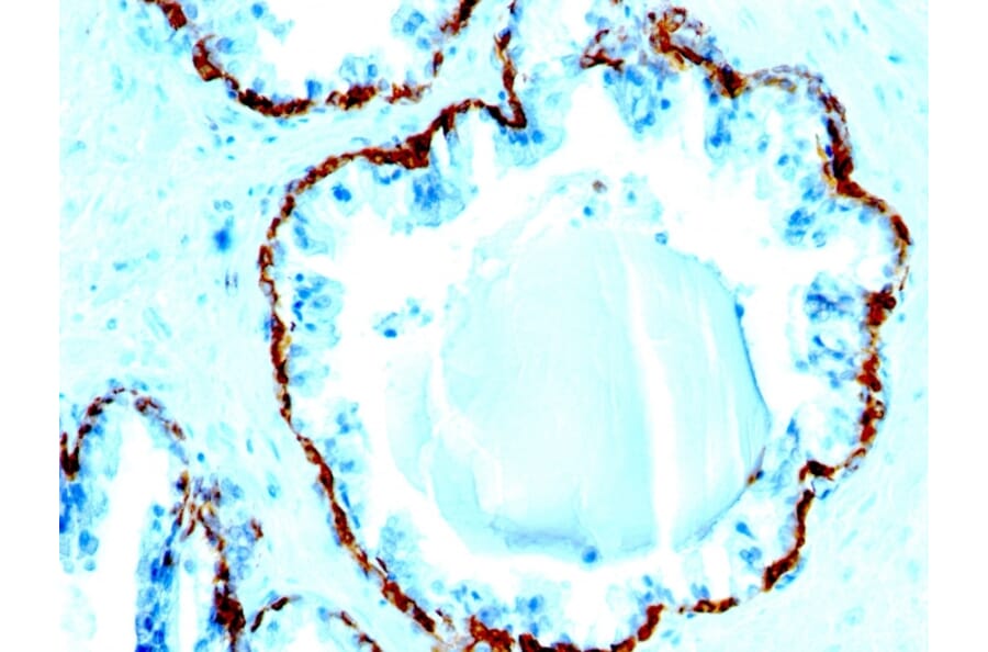 Immunohistochemistry - Anti-Basic Cytokeratin Antibody [SPM591] - BSA and Azide free (A254146) - Antibodies.com