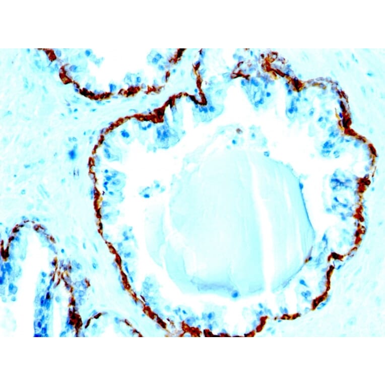 Immunohistochemistry - Anti-Basic Cytokeratin Antibody [SPM591] - BSA and Azide free (A254146) - Antibodies.com