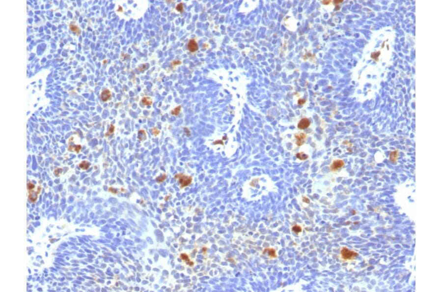 Immunohistochemistry - Anti-HPV16 Antibody [HPV16/1296] - BSA and Azide free (A254148) - Antibodies.com