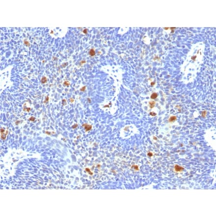 Immunohistochemistry - Anti-HPV16 Antibody [HPV16/1296] - BSA and Azide free (A254148) - Antibodies.com