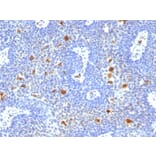 Immunohistochemistry - Anti-HPV16 Antibody [HPV16/1296] - BSA and Azide free (A254148) - Antibodies.com