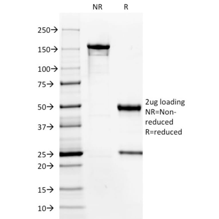 SDS-PAGE - Anti-HPV16 Antibody [HPV16/1296] - BSA and Azide free (A254149) - Antibodies.com