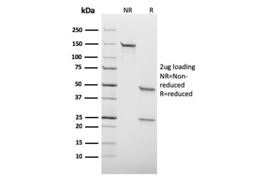 SDS-PAGE - Anti-HSV1 Antibody [HSV1/1934] - BSA and Azide free (A254151) - Antibodies.com