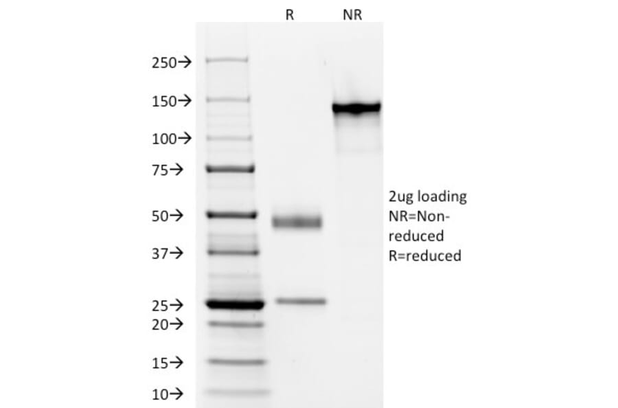 SDS-PAGE - Anti-Keratin 77 Antibody [AE-1] - BSA and Azide free (A254152) - Antibodies.com