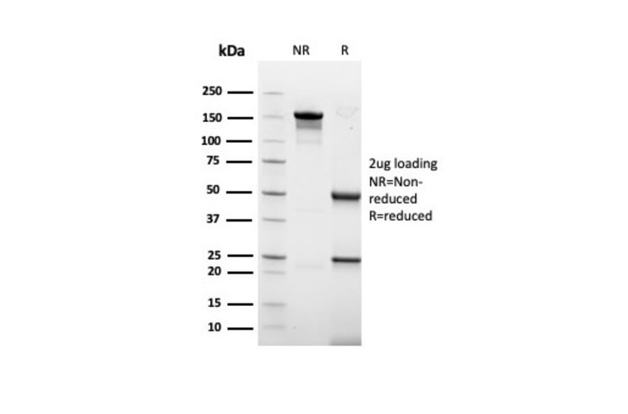 SDS-PAGE - Anti-Keratin 77 Antibody [rKRTL/6616] - BSA and Azide free (A254153) - Antibodies.com
