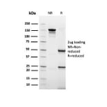 SDS-PAGE - Anti-Keratin 77 Antibody [rKRTL/6616] - BSA and Azide free (A254153) - Antibodies.com