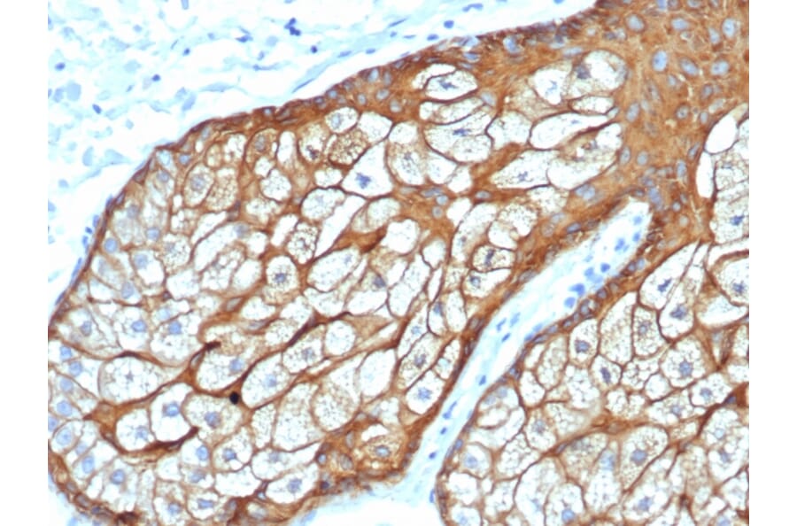 Immunohistochemistry - Anti-Keratin 76 Antibody [rKRTH/6617] - BSA and Azide free (A254153) - Antibodies.com