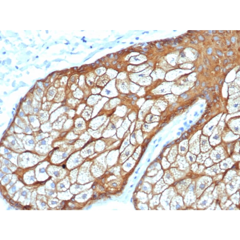 Immunohistochemistry - Anti-Keratin 76 Antibody [rKRTH/6617] - BSA and Azide free (A254153) - Antibodies.com