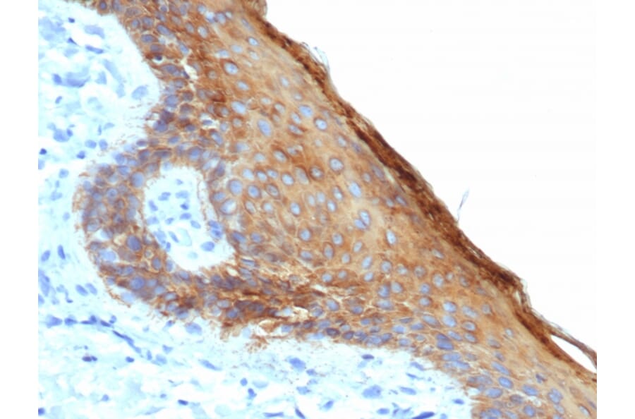 Immunohistochemistry - Anti-Keratin 76 Antibody [rKRTH/6617] - BSA and Azide free (A254154) - Antibodies.com