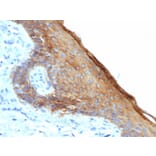 Immunohistochemistry - Anti-Keratin 76 Antibody [rKRTH/6617] - BSA and Azide free (A254154) - Antibodies.com