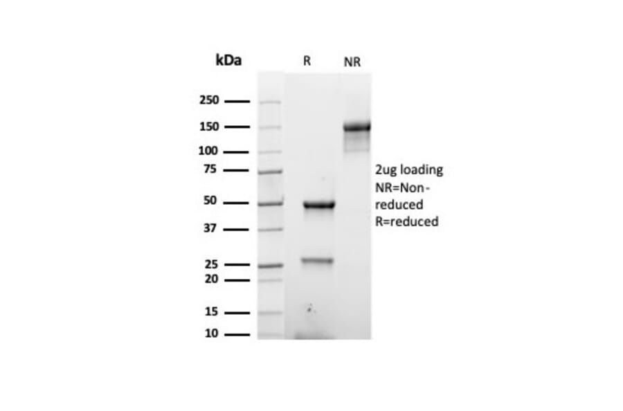 SDS-PAGE - Anti-Keratin 76 Antibody [rKRTH/6617] - BSA and Azide free (A254154) - Antibodies.com
