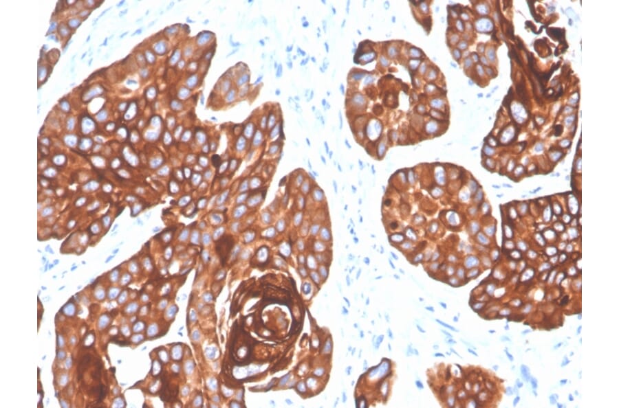 Immunohistochemistry - Anti-Cytokeratin 5 + 6 Antibody [KRT5.6/4866] - BSA and Azide free (A254155) - Antibodies.com