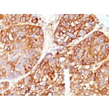 Immunohistochemistry - Anti-Melanoma Marker (MART-1 + Tyrosinase + gp100) Antibody [DT101+ BC199 + T311 + HMB45] - BSA and Azide free (A254155) - Antibodies.com