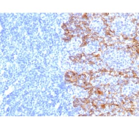 Immunohistochemistry - Anti-Keratin 77 Antibody [SPM115] - BSA and Azide free (A254159) - Antibodies.com