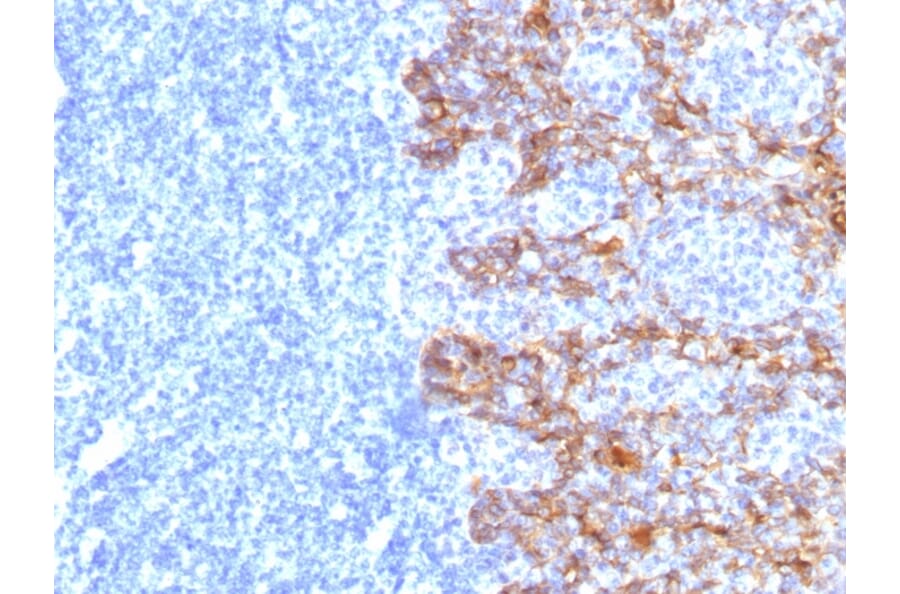 Immunohistochemistry - Anti-Keratin 77 Antibody [SPM115] - BSA and Azide free (A254159) - Antibodies.com