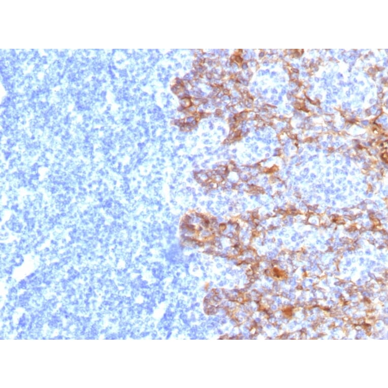 Immunohistochemistry - Anti-Keratin 77 Antibody [SPM115] - BSA and Azide free (A254159) - Antibodies.com