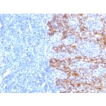 Immunohistochemistry - Anti-Keratin 77 Antibody [SPM115] - BSA and Azide free (A254159) - Antibodies.com