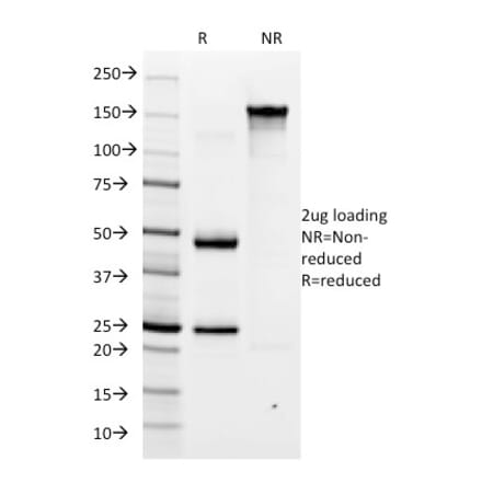 SDS-PAGE - Anti-Helicobacter pylori Antibody [HP/1335] - BSA and Azide free (A254160) - Antibodies.com