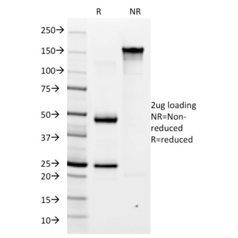 SDS-PAGE - Anti-Helicobacter pylori Antibody [HP/1335] - BSA and Azide free (A254160) - Antibodies.com