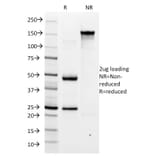 SDS-PAGE - Anti-Helicobacter pylori Antibody [HP/1335] - BSA and Azide free (A254160) - Antibodies.com