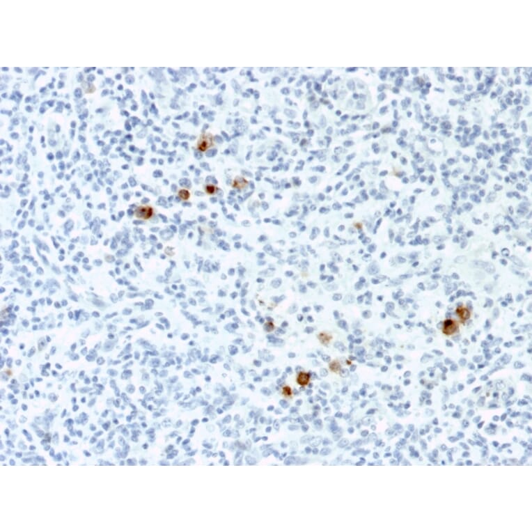 Immunohistochemistry - Anti-EBV LMP-1 Antibody [CS4] - BSA and Azide free (A254161) - Antibodies.com