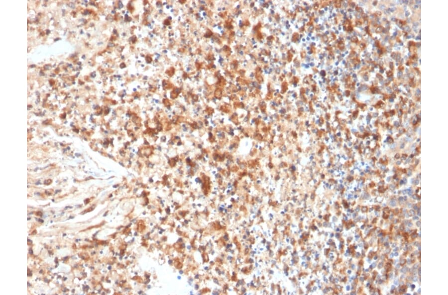 Immunohistochemistry - Anti-HSV1 Antibody [HSVI/2095] - BSA and Azide free (A254162) - Antibodies.com