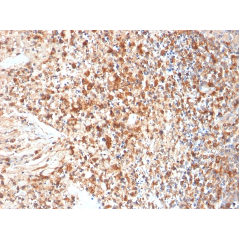 Immunohistochemistry - Anti-HSV1 Antibody [HSVI/2095] - BSA and Azide free (A254162) - Antibodies.com