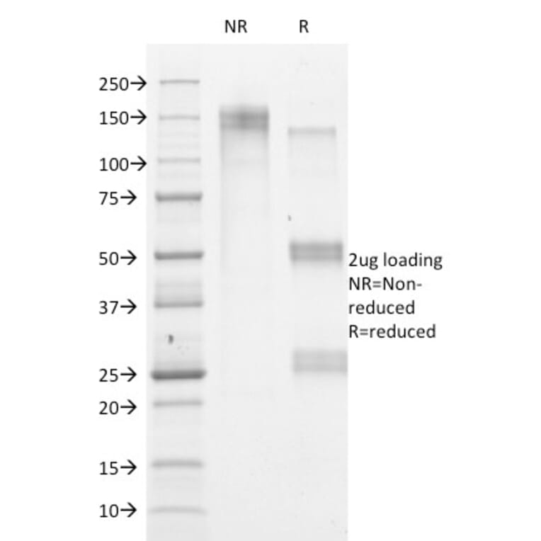SDS-PAGE - Anti-HSV1 Antibody [HSVI/2095] - BSA and Azide free (A254163) - Antibodies.com