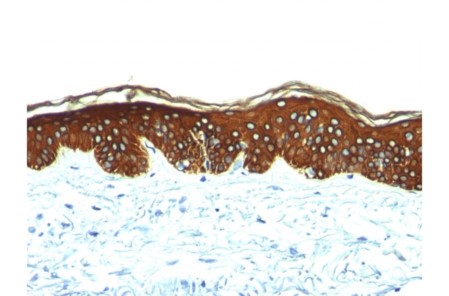 Immunohistochemistry - Anti-Keratin 76 Antibody [AE-3] - BSA and Azide free (A254163) - Antibodies.com