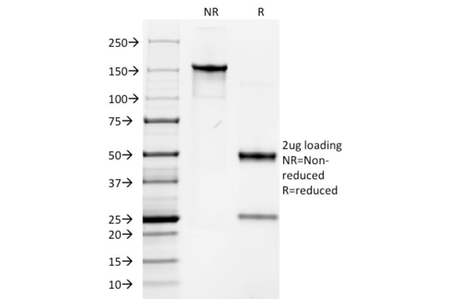SDS-PAGE - Anti-Keratin 76 Antibody [AE-3] - BSA and Azide free (A254164) - Antibodies.com