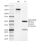 SDS-PAGE - Anti-Keratin 76 Antibody [AE-3] - BSA and Azide free (A254164) - Antibodies.com