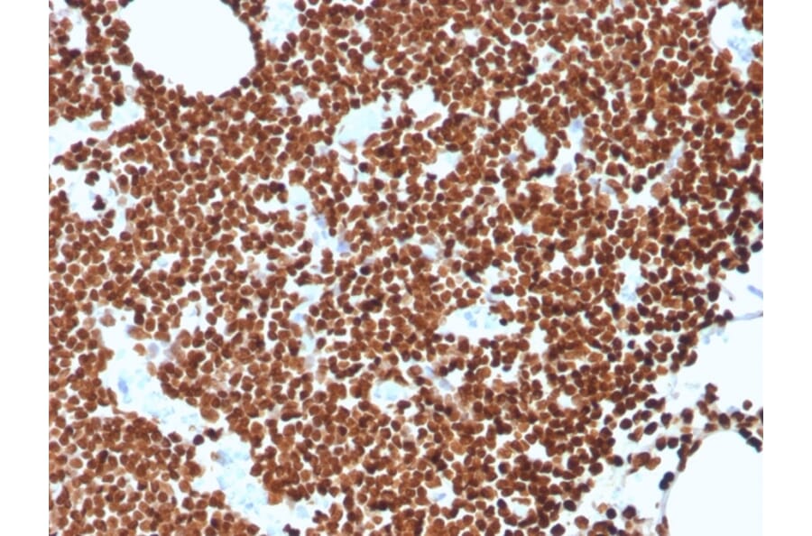 Immunohistochemistry - Anti-ds DNA Antibody [rDSD/4565] - BSA and Azide free (A254165) - Antibodies.com