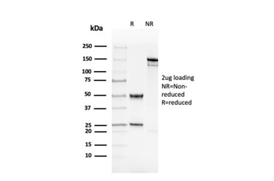 SDS-PAGE - Anti-ds DNA Antibody [rDSD/4565] - BSA and Azide free (A254165) - Antibodies.com