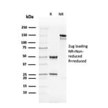 SDS-PAGE - Anti-ds DNA Antibody [rDSD/4565] - BSA and Azide free (A254165) - Antibodies.com