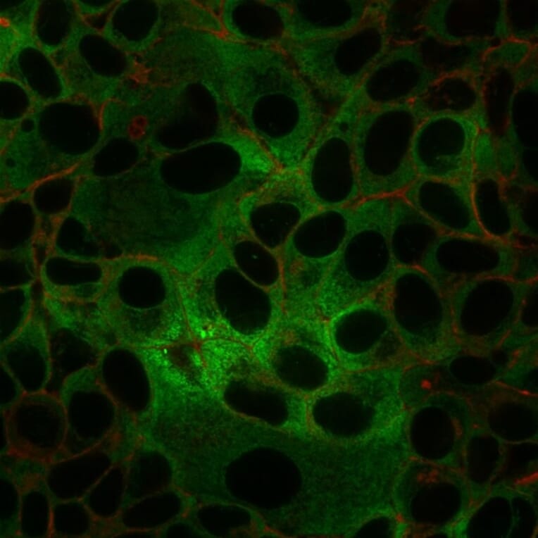 Immunofluorescence - Anti-ds DNA Antibody [rDSD/4565] - BSA and Azide free (A254164) - Antibodies.com