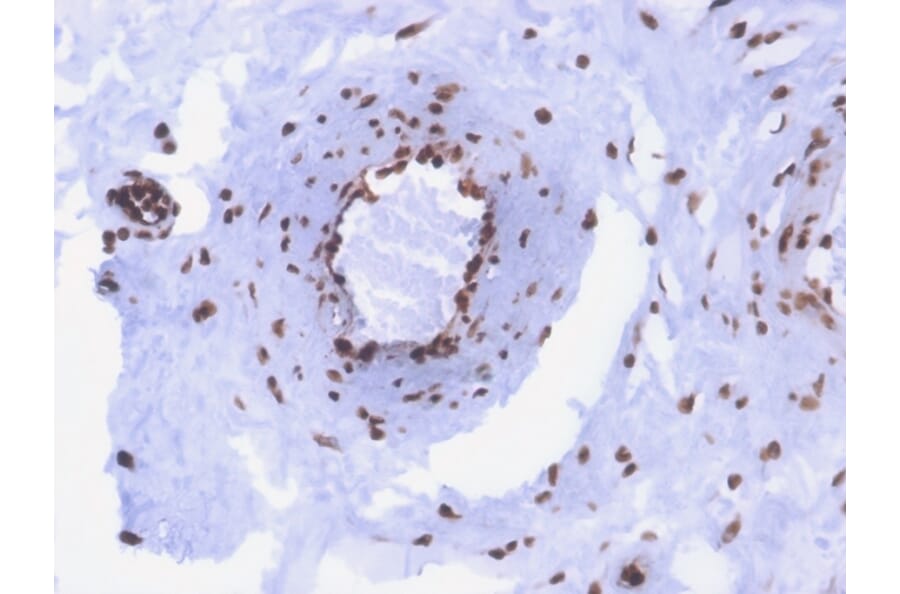 Immunohistochemistry - Anti-ds DNA Antibody [rDSD/4565] - BSA and Azide free (A254165) - Antibodies.com